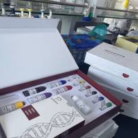 大鼠血管生成素受体Tie2(ANG-R-Tie2)ELISA试剂盒