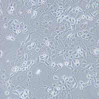 KLE、KLE细胞、人子宫内膜癌细胞/STR鉴定