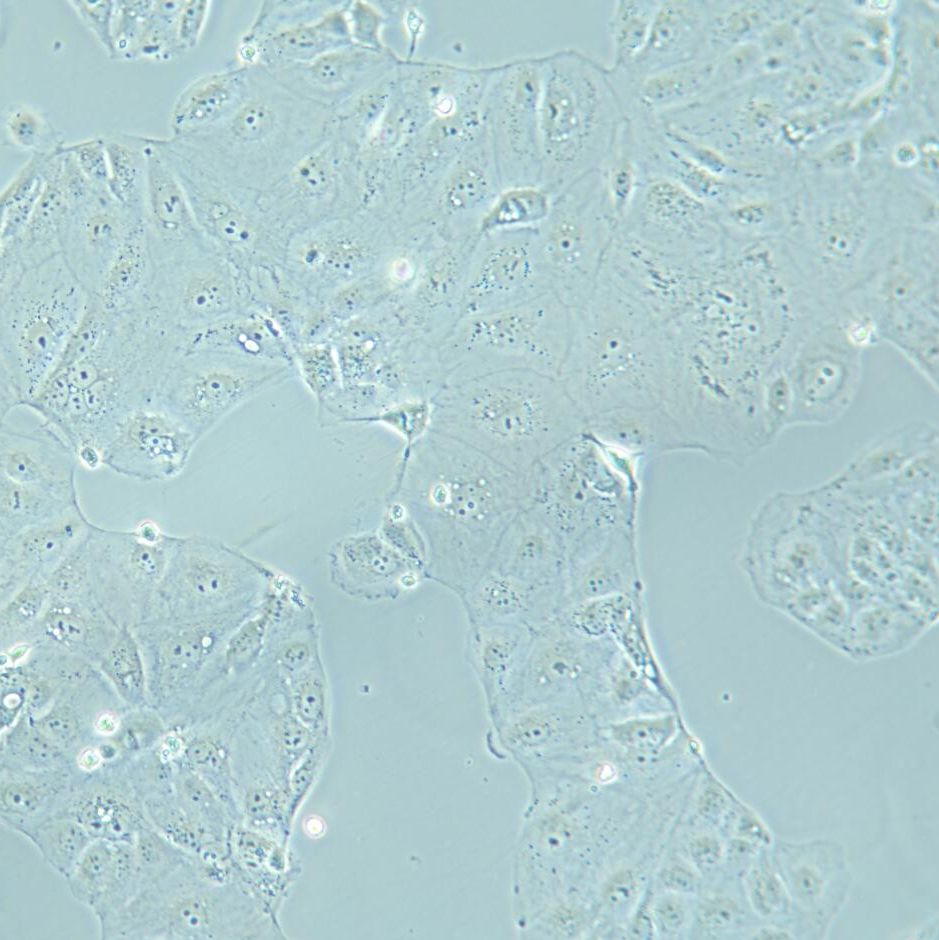 HuH-6 人肝母细胞瘤细胞  STR鉴定