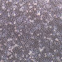 HUTU-80 人十二脂肠腺癌细胞/STR鉴定