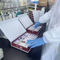 大鼠抑瘤素M(OSM)ELISA试剂盒