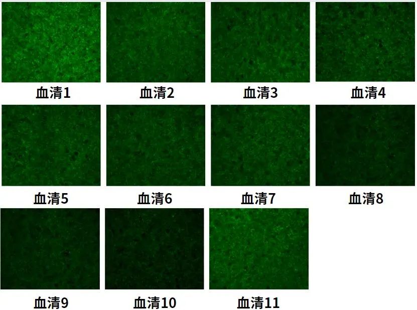 血清怎么选？细胞实验大pk有图有真相
