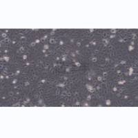 HUCCT1人胆管上皮癌细胞