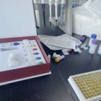 人毒性休克综合征毒素1(TSST-1)ELISA试剂盒
