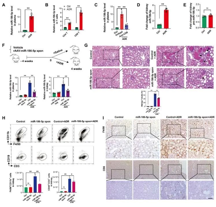 IF=17.521|揭秘T细胞源性外泌体miRNA促进肾功能障碍机制
