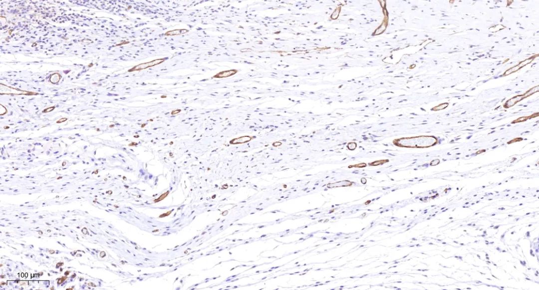 免疫组化丨免疫组化步骤及注意事项