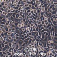 AGS人胃腺癌细胞（STR鉴定）