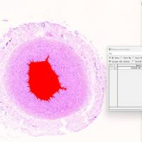 病理形态测量分析