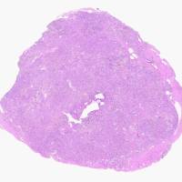 病理染色片显微拍照扫描