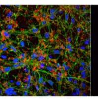 Alpha Synuclein 抗体 (特异识别聚集体)