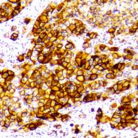 免疫组化阅片评分