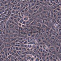 J82人膀胱移行细胞癌