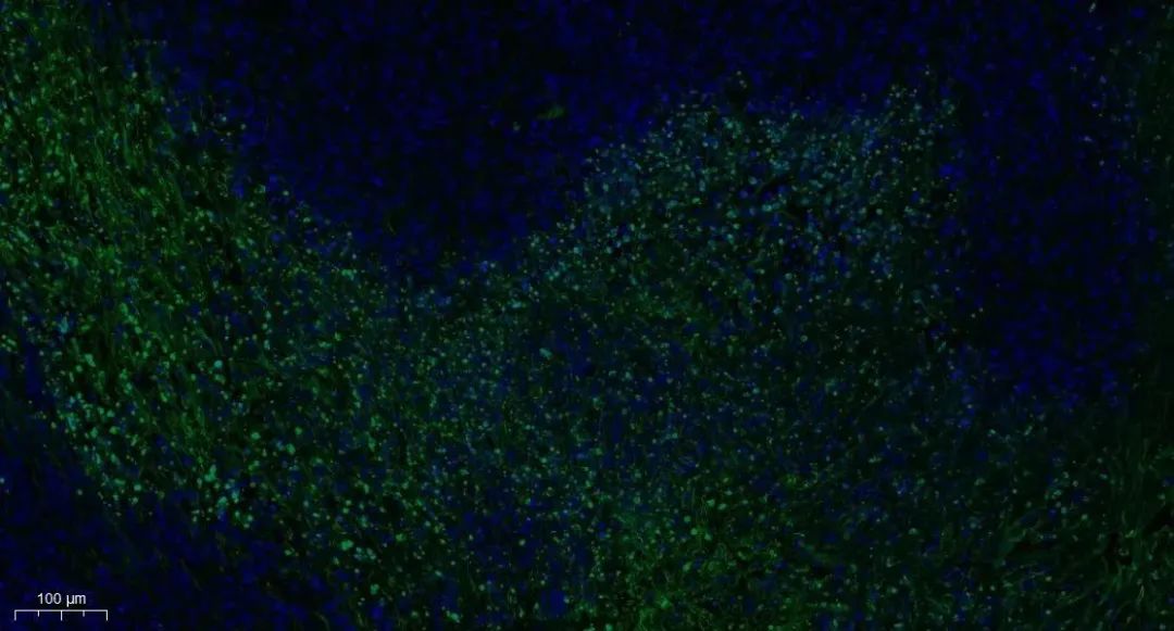 组织/细胞凋亡丨Tunel染色