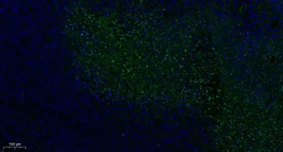 组织/细胞凋亡丨Tunel染色