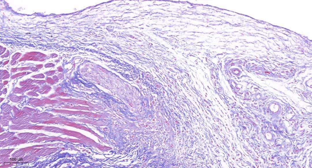特殊染色丨Masson染色