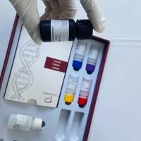 人抗滋养膜细胞抗体(ATA)ELISA试剂盒