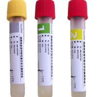 病原体血清学复合非定值质控品