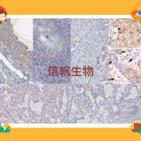 免疫组化（IHC）实验代测