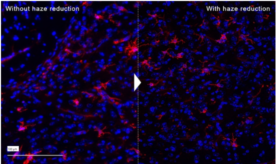 柏林夏里特医学院附属医院：非常适合患者的日常诊断和临床研究的解决方案
