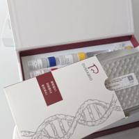 人CCAAT增强子结合蛋白δ(C/EBPδ)ELISA试剂盒