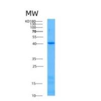 人乙酰辅酶A酰基转移酶2(ACAA2)重组蛋白