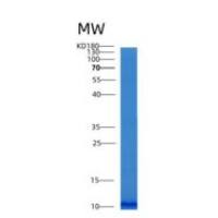 人ABRACL重组蛋白