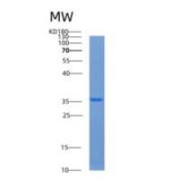 人氨基乙二酸半醛磷酸泛酰巯基乙胺基转移酶(AASDHPPT)重组蛋白
