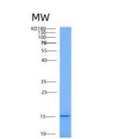 人AAMDC重组蛋白