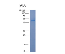人ACAD8重组蛋白