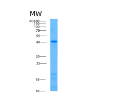 人乙酰辅酶A酰基转移酶1(ACAA1)重组蛋白