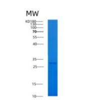 人14-3-3 γ/YWHAG重组蛋白