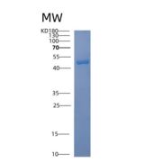 人ACAD8重组蛋白