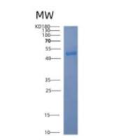 人ACAD8重组蛋白