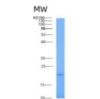 人A2LD1重组蛋白
