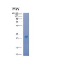 人14-3-3 β/YWHAB重组蛋白