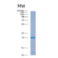 人ABHD14B重组蛋白