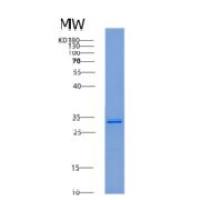 人14-3-3 ζ/YWHAZ重组蛋白