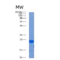 人Acid phosphatase 1重组蛋白