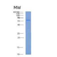 人腺苷裂解酶(ADSL)重组蛋白