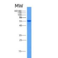 小鼠Aldh2重组蛋白