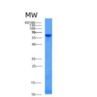 人甲胎蛋白(AFP)重组蛋白