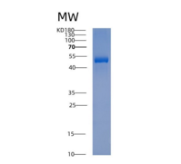 人肌动蛋白相关蛋白3(ACTR3)重组蛋白