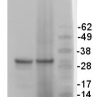V-ATPase | Epsilon subunit of tonoplast H+ATPase