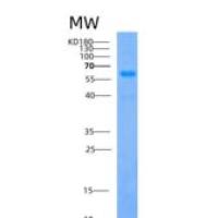 人酰基辅酶A合成酶家族成员2(ACSF2)重组蛋白
