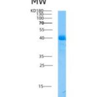 人α2-HS糖蛋白(AHSG)重组蛋白