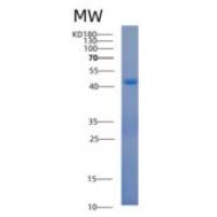 人细胞质酰基辅酶a硫酯水解酶(ACOT7)重组蛋白