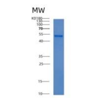 小鼠氨基酰化酶1(ACY1)重组蛋白