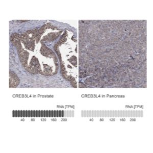 CREB3L4 Polyclonal Antibody（IHC (P) ICC/IF）