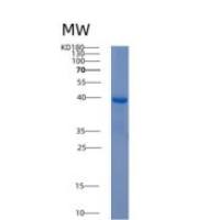 人AKR1C4重组蛋白