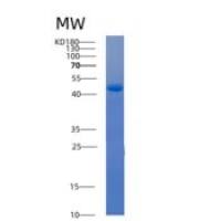 人E.col iackA重组蛋白